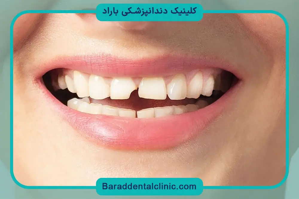 بررسی عملکرد داروی بازسازی دندان 