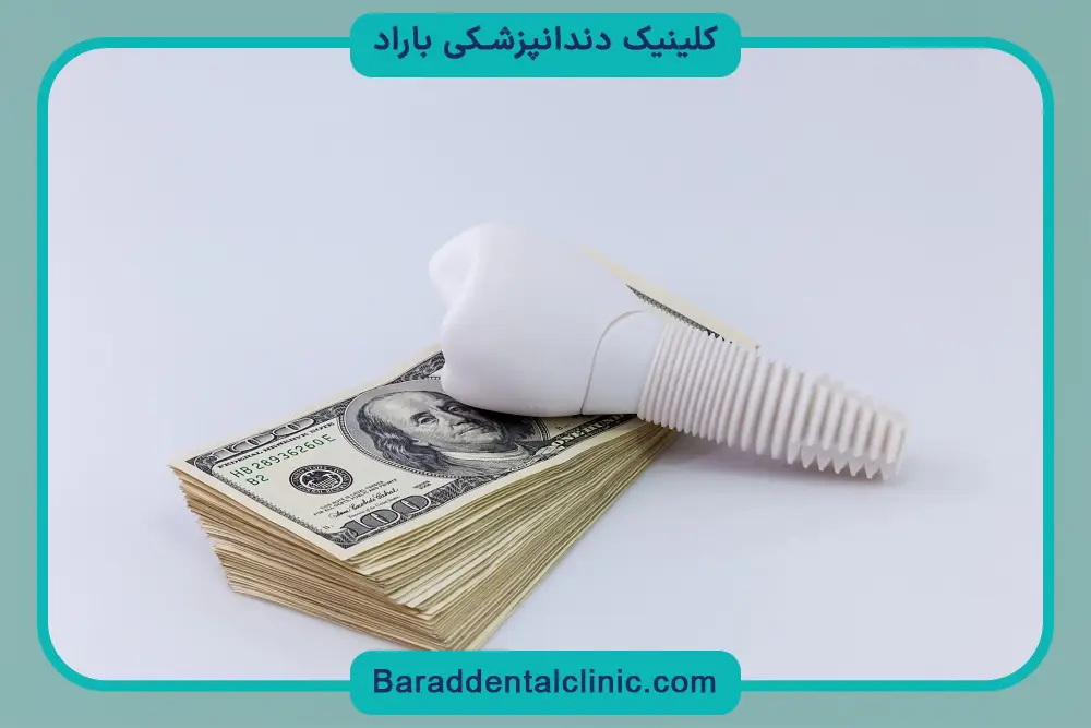 ایمپلنت دیجیتال چقدر طول میکشه؟ جدول زمانی