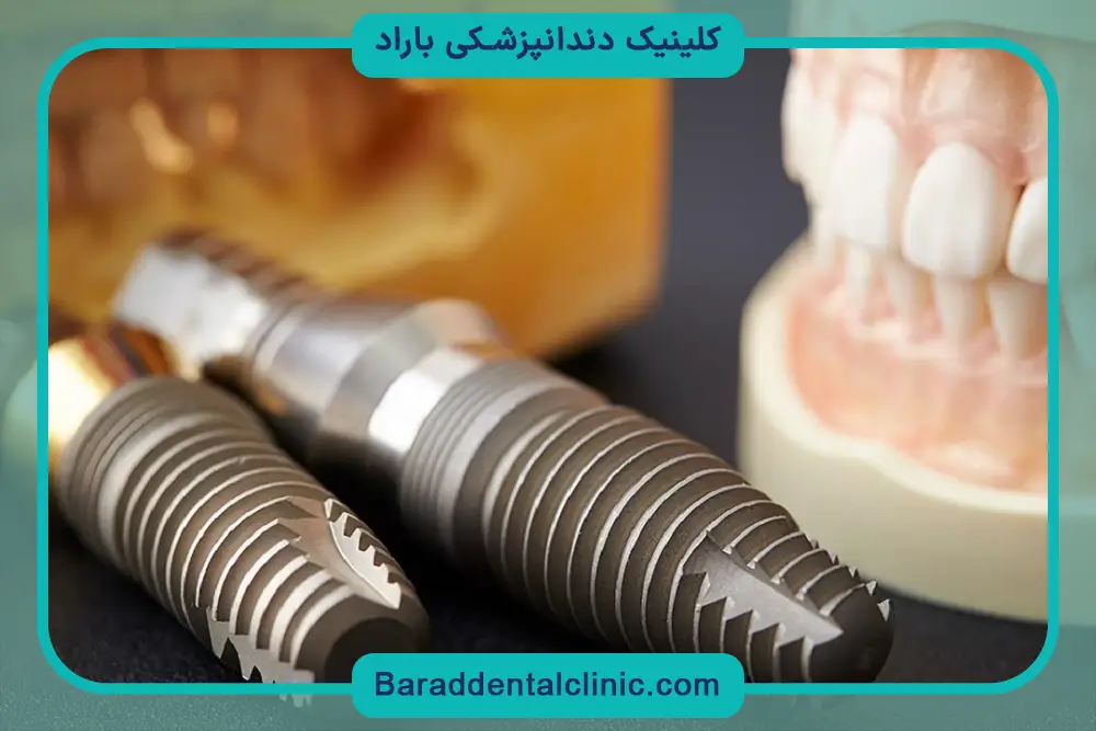 میزان درد ایمپلنت با بی حسی دیجیتال 