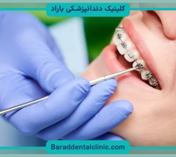 هزینه ارتودنسی