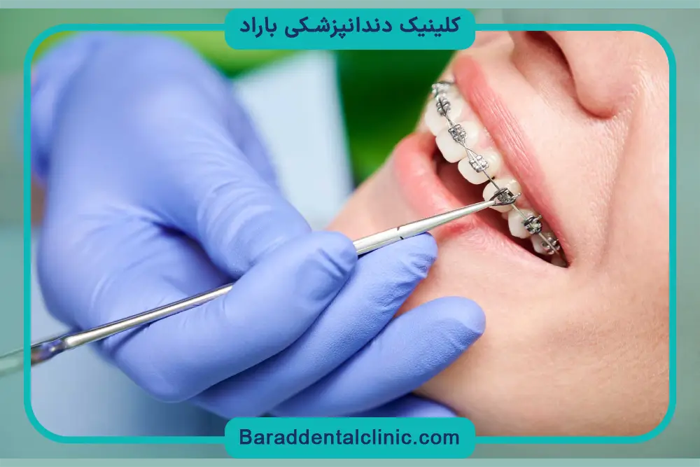 هزینه ارتودنسی