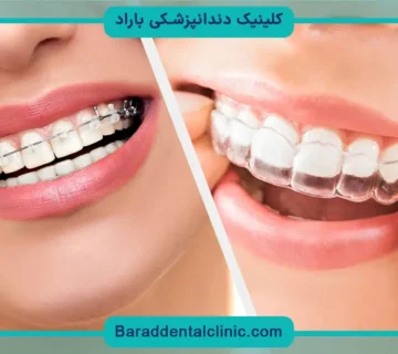 قیمت ارتودنسی ثابت و متحرک
