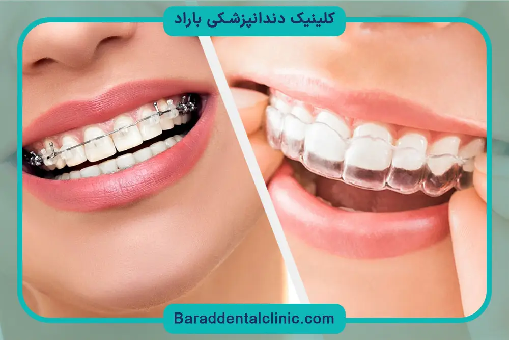 قیمت ارتودنسی ثابت و متحرک