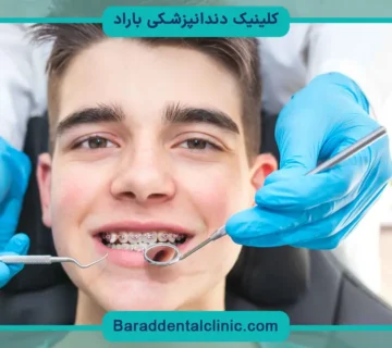 هزینه سیم کشی دندان
