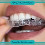 هزینه ارتودنسی