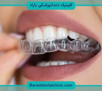 هزینه ارتودنسی