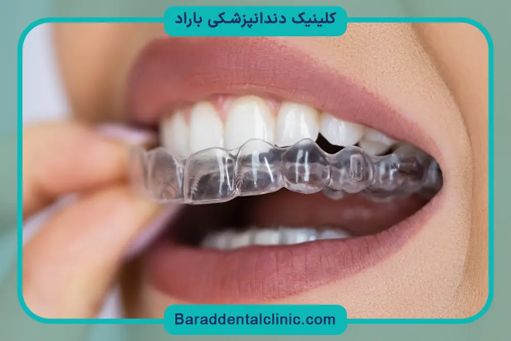 هزینه ارتودنسی