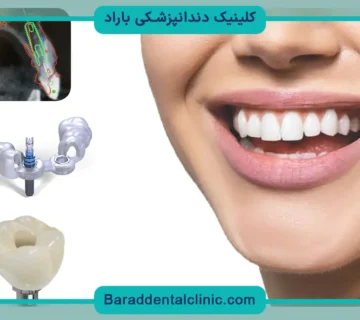 هزینه ایمپلنت دندان با بیمه تامین اجتماعی