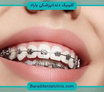 مراقبت بعد از رگلاژ