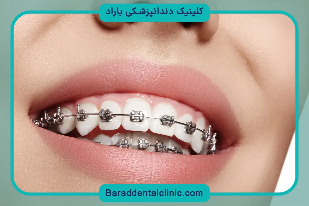 مراقبت بعد از رگلاژ