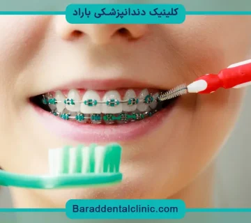 مسواک ارتودنسی