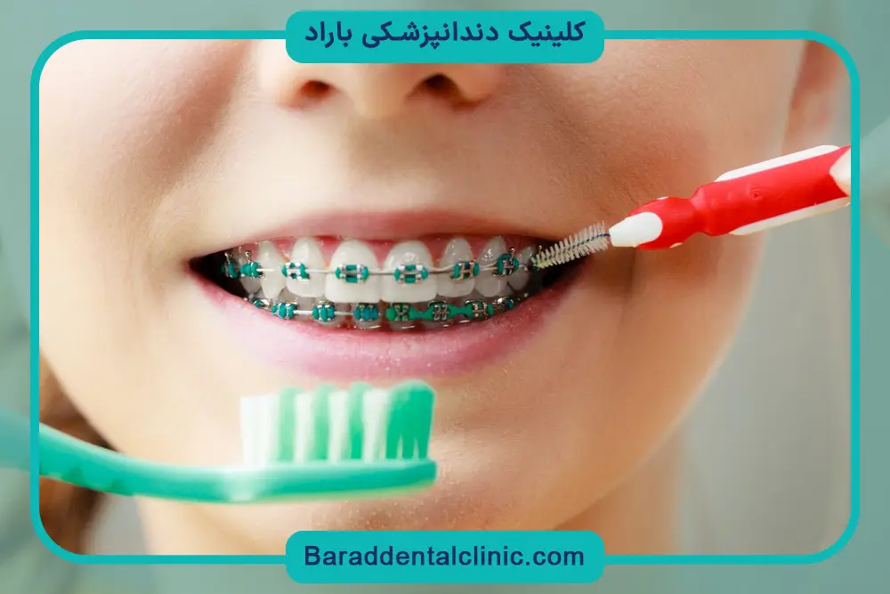 مسواک ارتودنسی