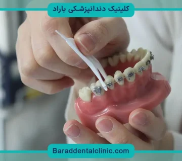 نخ دندان ارتودنسی