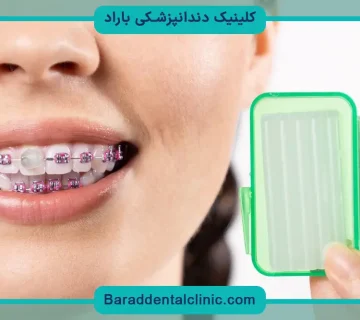 موم ارتودنسی