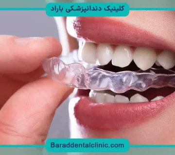 صاف كردن دندان در خانه