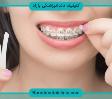مرتب سازی دندان ها