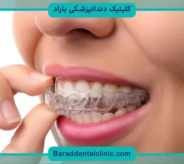 صاف كردن دندان نيش