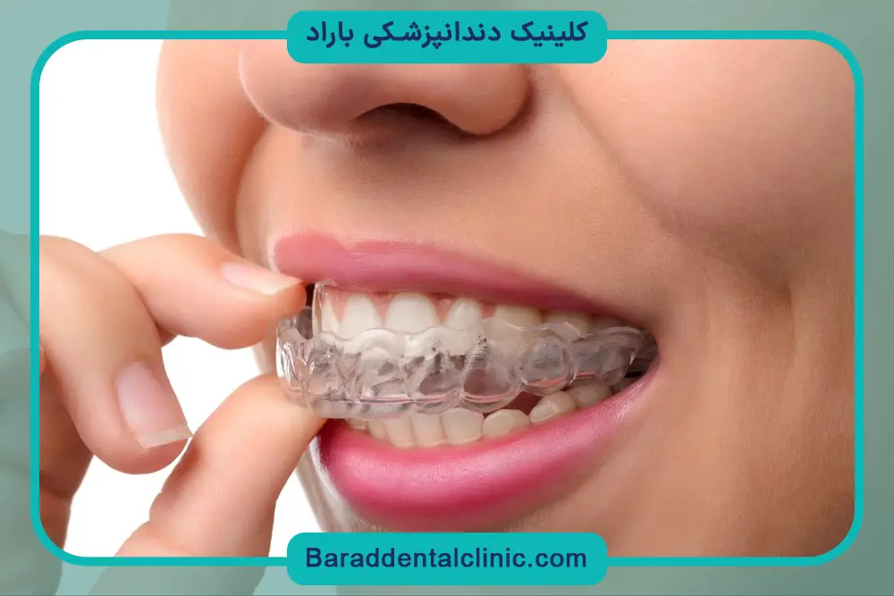 صاف كردن دندان نيش