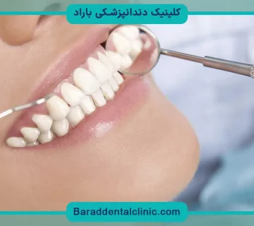 کاشت دندان اقساطی