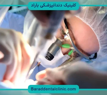 جراحی ایمپلنت فک بالا