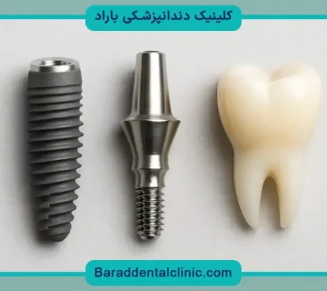 فیکسچر ایمپلنت دندان