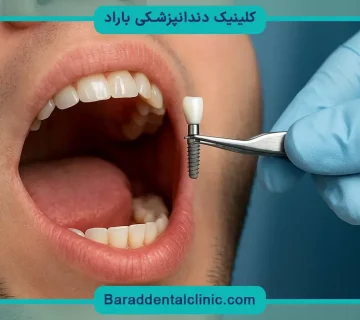 ایمپلنت دندان درد دارد؟