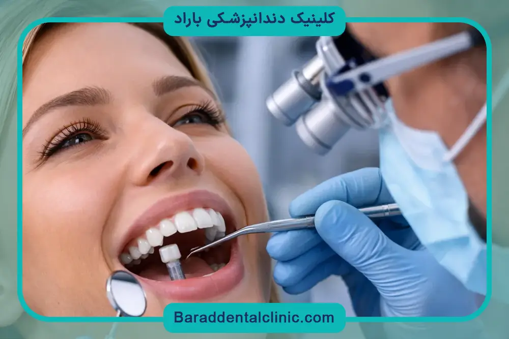 فیلم ایمپلنت دندان