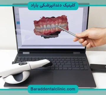 ایمپلنت دیجیتال پاسداران