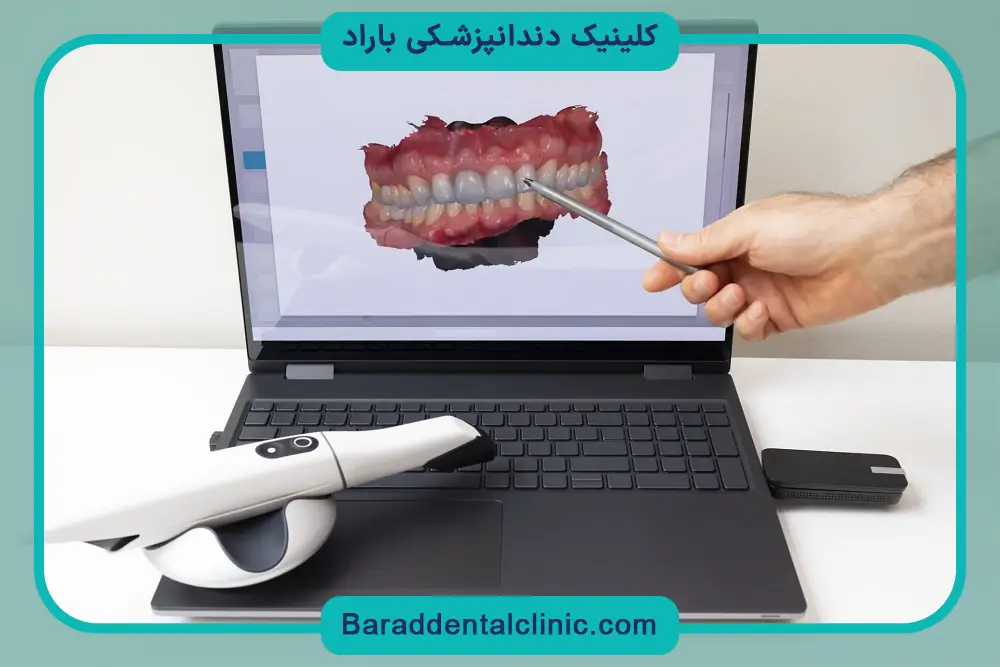 ایمپلنت دیجیتال پاسداران
