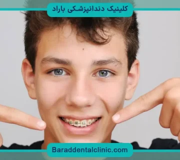 قیمت سیم کشی دندان پسرانه