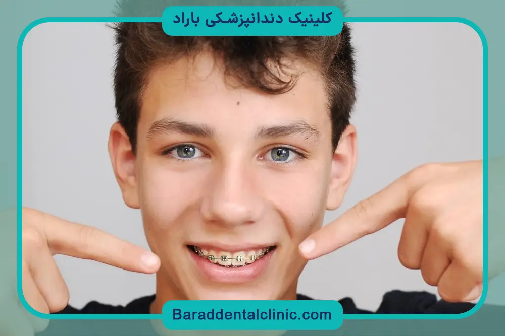 قیمت سیم کشی دندان پسرانه