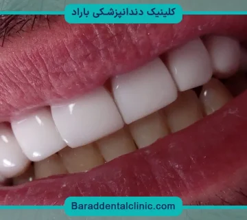 کامپوزیت جنت آباد