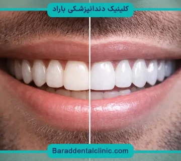 کامپوزیت تهران