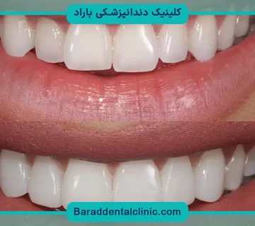 کامپوزیت پاسداران