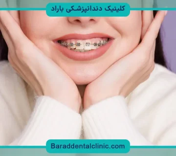 سیم‌ پیچی دندان
