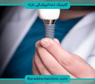 ایمپلنت دیجیتال بدون جراحی
