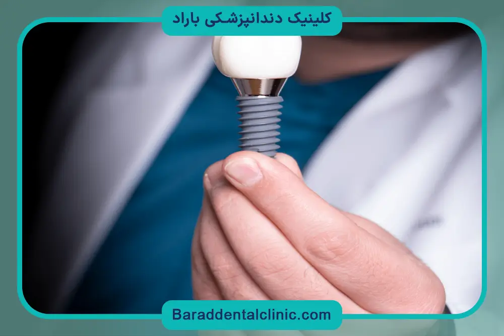 ایمپلنت دیجیتال بدون جراحی
