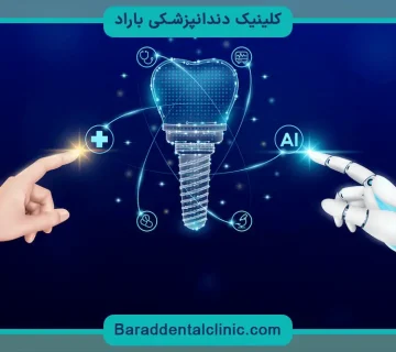 ایمپلنت دیجیتال در تهران