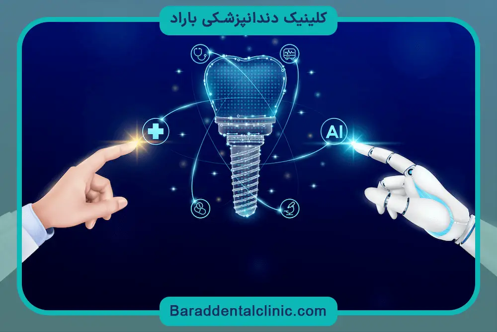 ایمپلنت دیجیتال در تهران