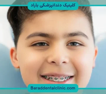 عکس سیم کشی دندان پسرانه