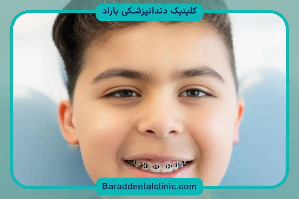 عکس سیم کشی دندان پسرانه