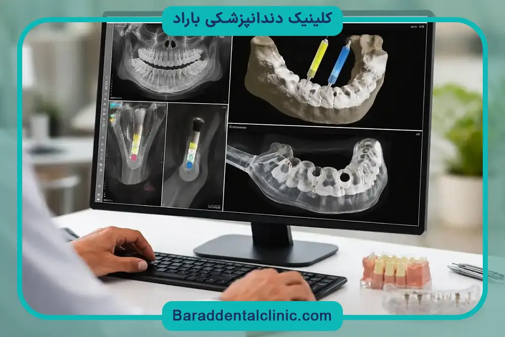 عمر ایمپلنت دیجیتال