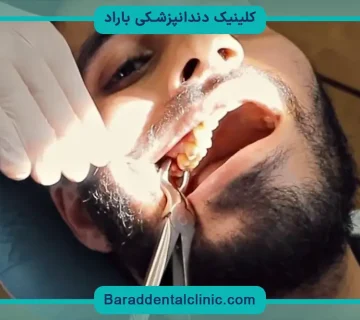 جراحی سیم‌کشی دندان