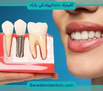 ایمپلنت با بی حسی دیجیتال