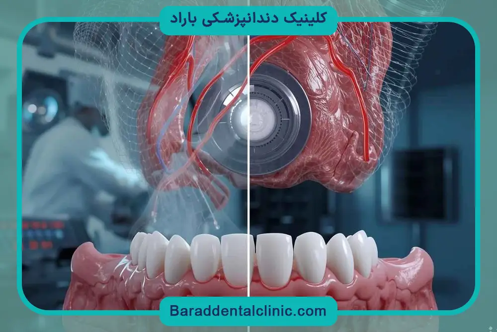 معایب ایمپلنت دیجیتال