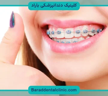 سیم کشی دندان چند تومان است