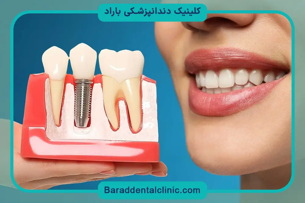 ایمپلنت با بی حسی دیجیتال