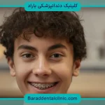 هزینه سیم کشی دندان چقدر است؟