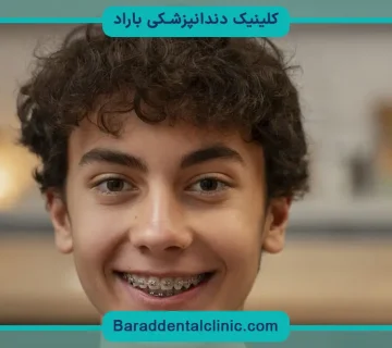 هزینه سیم کشی دندان چقدر است؟
