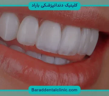 قیمت کامپوزیت